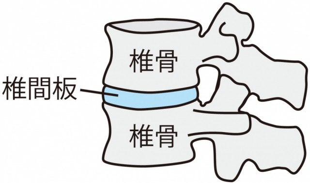 椎骨のイラスト